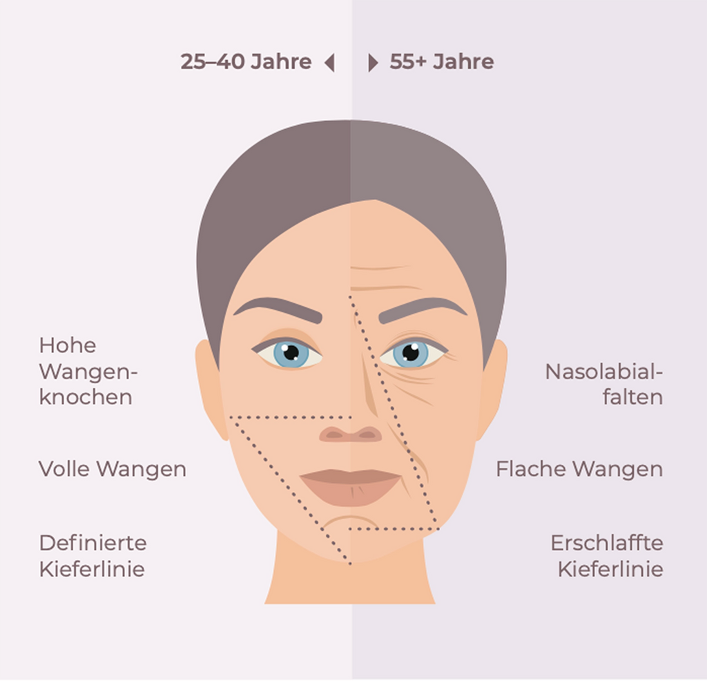 SILHOUETTE SOFT 8 Cones (5 x 2 Fäden)
